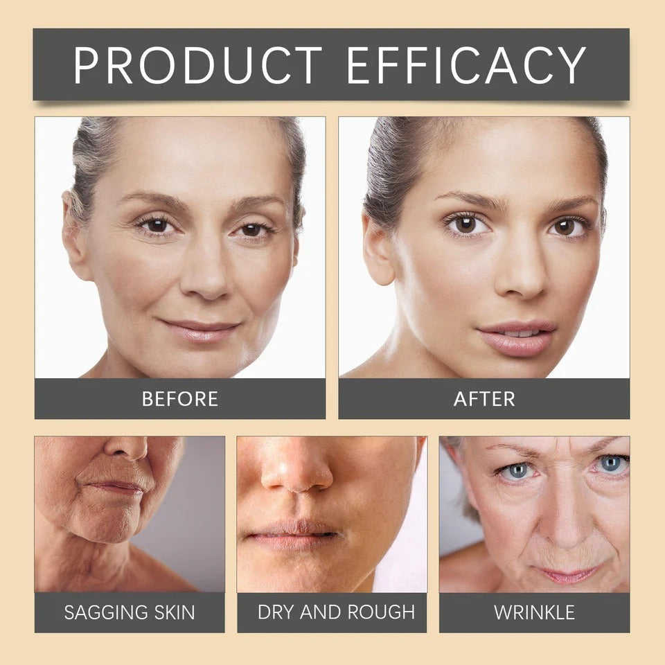 Botox Bee Venom Wrinkle Cream | Anti‑Aging Moisturizer | Collagen Boost | Reduce Wrinkles & Fine Lines 20gm