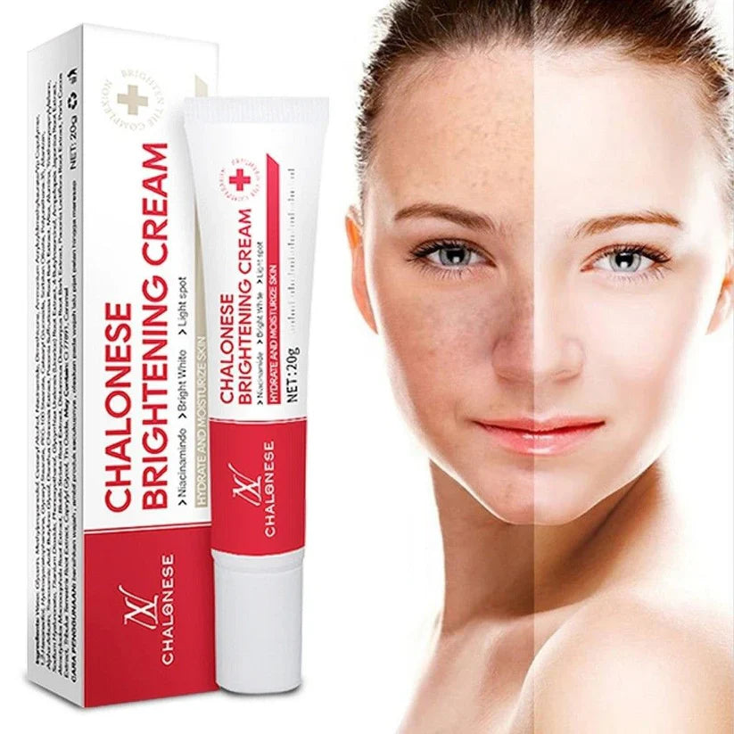 Chalonese Brightening Cream – Buy 1 Get 1 Free