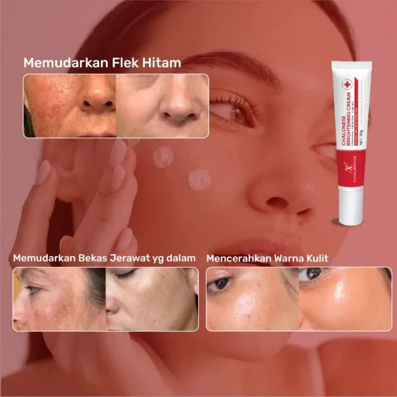 Chalonese Brightening Cream – Buy 1 Get 1 Free