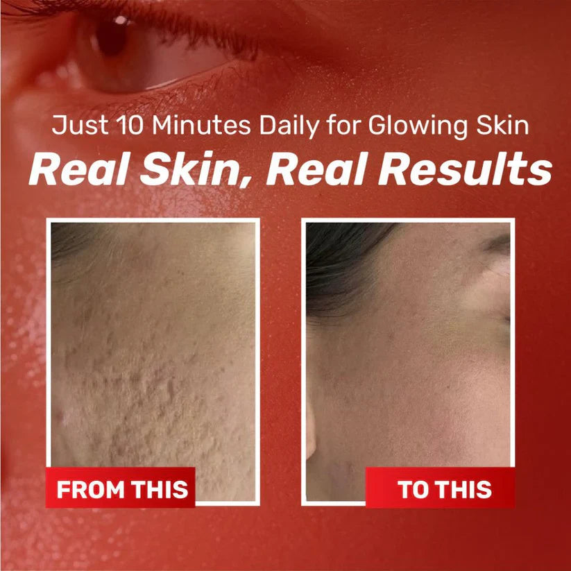 Chalonese Brightening Cream – Buy 1 Get 1 Free
