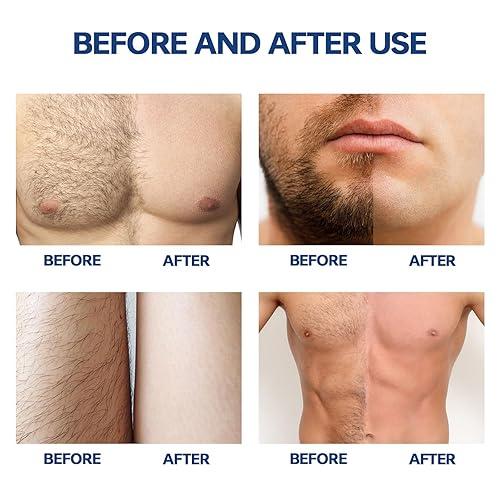 Glame Hair Removal Spray for Men and Women